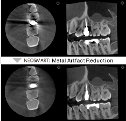 NEOSMART *Standard function