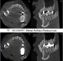 NEOSMART *Standard function
