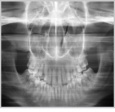 Maxillary sinus: 8 sec.