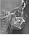 Cephalometric (Lateral, Short time):  2.9 sec.