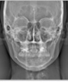 Cephalometric (PA): 4 sec.