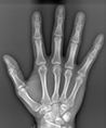 Bones of Carpus: 4 sec.
