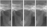 Lateral TMJ: 3 sec. (x4) 
