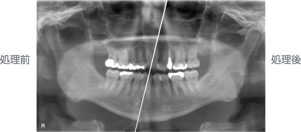 歯科用パノラマ・断層撮影X線診断装置SOLIO XD - 朝日レントゲン工業