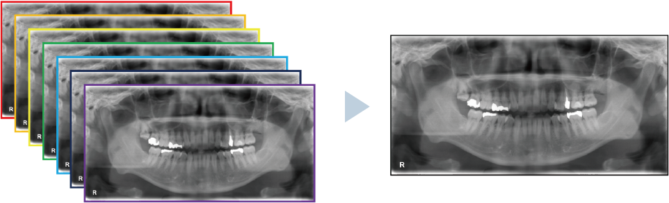 歯科用パノラマ・断層撮影X線診断装置SOLIO XD - 朝日レントゲン工業